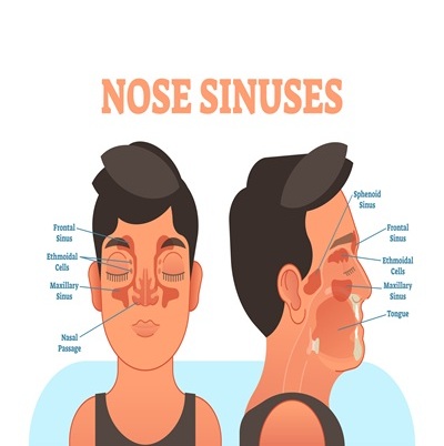 Nose Sinus: কারণ, লক্ষণ, সমস্যা ও চিকিৎসা Nose Sinus কী